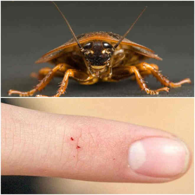Какие тараканы кусают человека и чем лечить укусы?