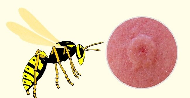 Чем полезен укус осы или пчелы
